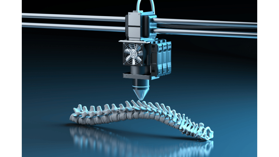 additive manufacturing (spine)