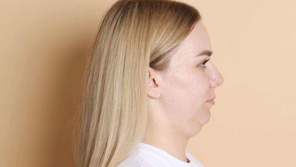 A side profile of a woman performing a chin tuck exercise, pulling her head back to align her neck. This movement is a key physical therapy technique to alleviate tech neck symptoms and maintain spinal health during intensive research.